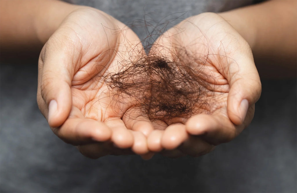 Consejos para minimizar la caída del cabello